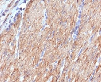 SMMHC Antibody (Smooth Muscle Myosin Heavy Chain)