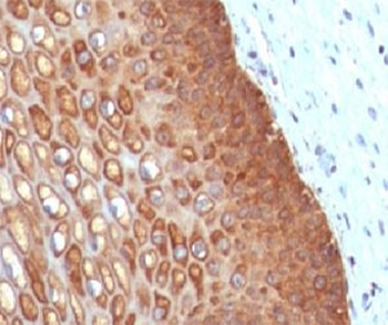 Cytokeratin 14 Antibody / CK14 / KRT14