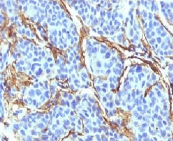 NGF Receptor Antibody / p75NTR / CD271