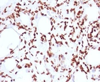 Histone H1 Antibody