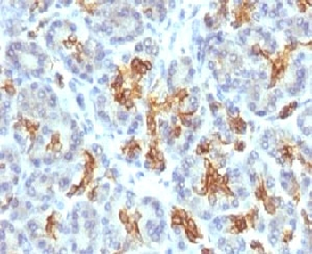 KRT19 Antibody / Cytokeratin 19