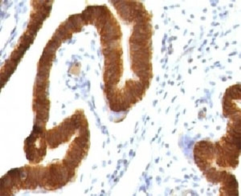 KRT19 Antibody / Cytokeratin 19