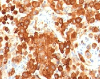 PMEL17 Antibody / Melanoma gp100
