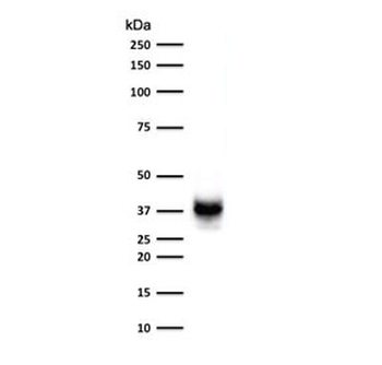 PMEL17 Antibody / Melanoma gp100