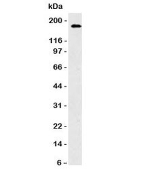 NCAM / CD56 Antibody