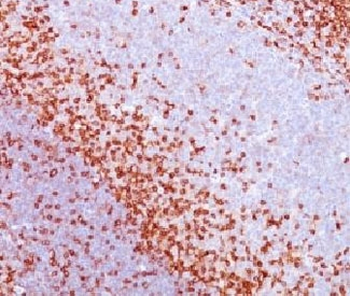 CD43 Antibody