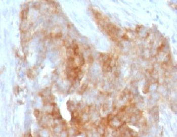 Fascin Antibody