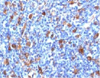 Fascin Antibody