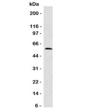 Fascin Antibody