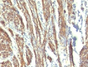 Caldesmon / CAD Antibody (HMW)