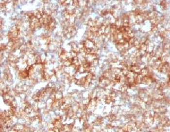 CD147 Antibody