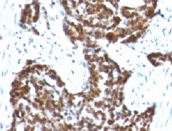 Cyclin B1 Antibody