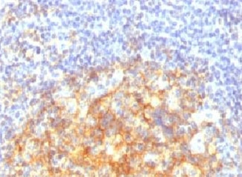 VCAM-1 Antibody