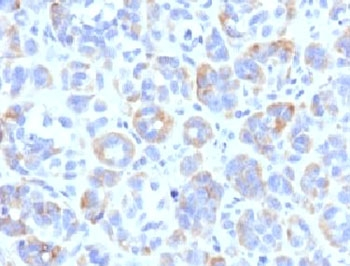 TRP1 Antibody / Tyrosinase-Related Protein-1 / TYRP1