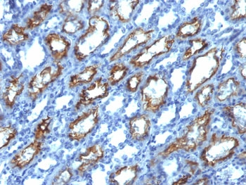 Interferon gamma Antibody / IFNG