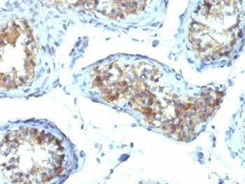 Interferon gamma Antibody / IFNG