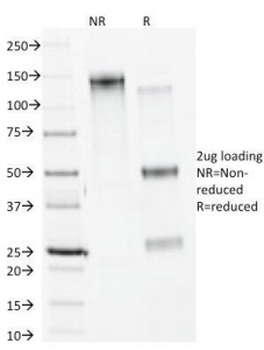 Calnexin Antibody