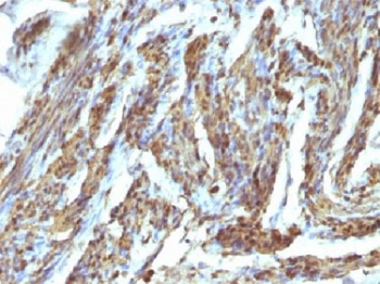 Calponin 1 Antibody