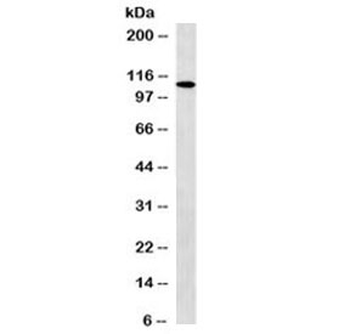 Retinoblastoma Antibody / Rb1