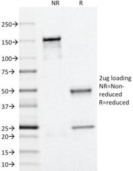 Adipophilin Antibody / Perilipin 2 / ADRP / PLIN2