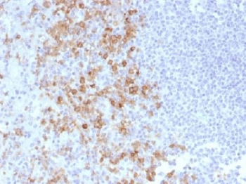 CD162 Antibody / P selectin glycoprotein ligand 1 / PSGL-1