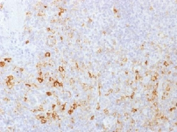 CD162 Antibody / P selectin glycoprotein ligand 1 / PSGL-1