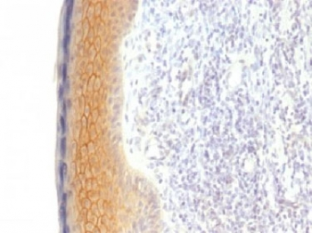 Gamma Catenin Antibody / Plakoglobin