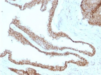 Gamma Catenin Antibody / Plakoglobin