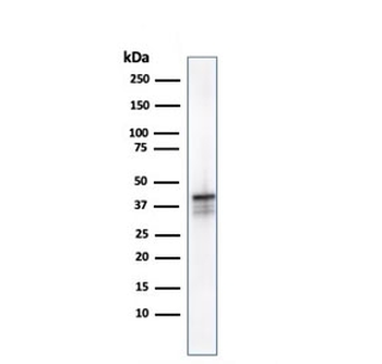 AMACR / p504S Antibody (Prostate Cancer Marker)