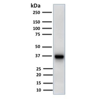 AMACR / p504S Antibody (Prostate Cancer Marker)