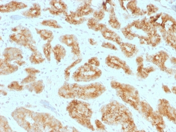 AMACR / p504S Antibody (Prostate Cancer Marker)