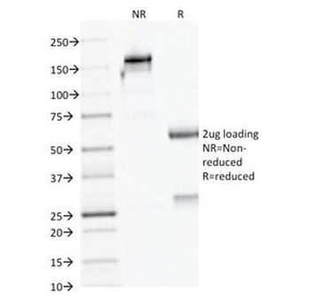 AMACR / p504S Antibody (Prostate Cancer Marker)
