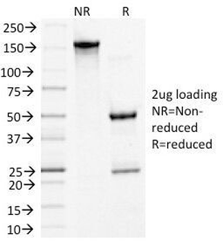 Desmoglein 3 Antibody / DSG3