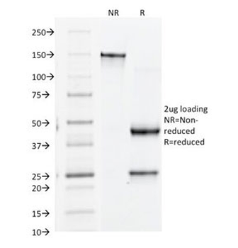 Integrin beta 3 Antibody / ITGB3 / CD61
