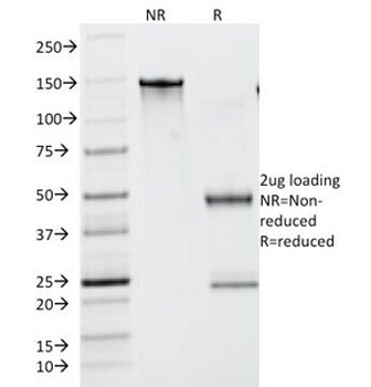 Lambda Light Chain Antibody / Lambda Antibody