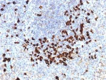 Lambda Light Chain Antibody