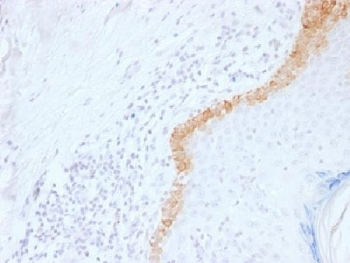 KRT15 Antibody / Cytokeratin 15