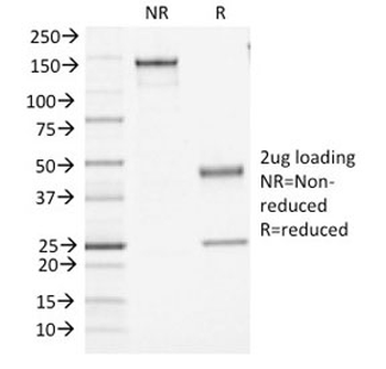 CD45 Antibody (Leukocyte marker)