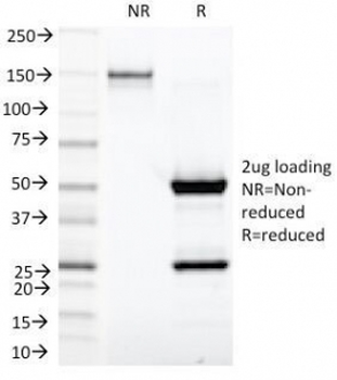 Kappa Light Chain Antibody