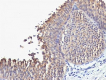 Cytokeratin 10 Antibody