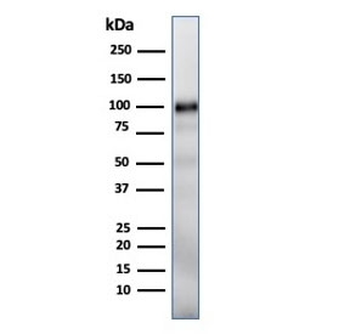 Glycoprotein 2 Antibody / GP2 / ZAP75