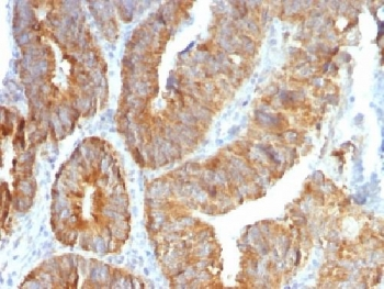 TNFSF15 Antibody / VEGI / TL1A