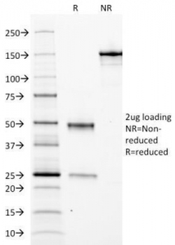 FTL Antibody / Ferritin light chain