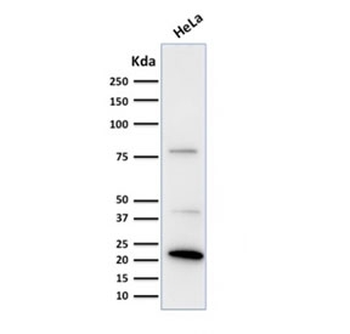 FTL Antibody / Ferritin light chain