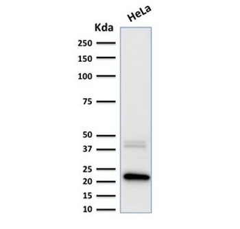 FTL Antibody / Ferritin light chain