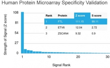 FTL Antibody / Ferritin light chain
