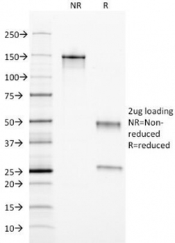FTL Antibody / Ferritin light chain