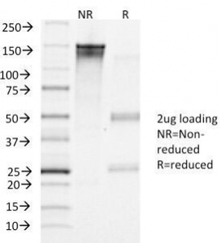 hCG Receptor / LH Receptor Antibody