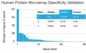 Growth Hormone Antibody / GH1