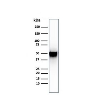 Thymidine Phosphorylase Antibody / PD-ECGF